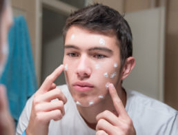 The Best Moisturizers for Acne