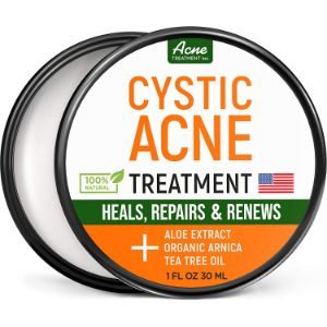 Cystic Acne Treatment and Acne Scar Remover
