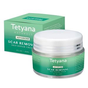 Tetyana Naturals Scar Removal Cream